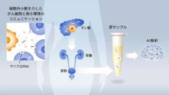 尿検査で膵臓がん早期発見　慶大、北大、北斗病院など、マイクロＲＮＡ用い